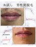 【スピード実感No.1！】men'sヒゲ脱毛7箇所一気に施術！¥31,360→¥3,980