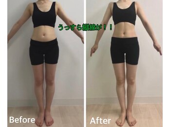 セラビシャン/before→after【全身】