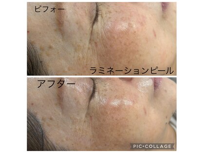 ダオン(DAON)の写真