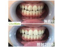 ルブラン 奈良店(Le Blanc)/格安ホワイトニング！
