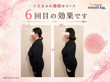 ヨサパーク ナナラーレア 福島店(YOSA PARK nanala lea)