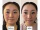 アランチャンティック(AlamCantik)の写真