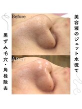 リノ(Lino)/お肌の変化に感動のお声多数