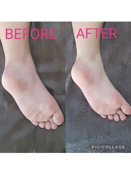 リリ(RIRI)/ガサガサ足裏からツルスベケア♪