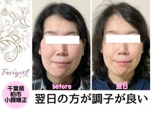 フェイシー(faceyee)/