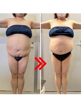 ベル(Belle)/脂肪冷却