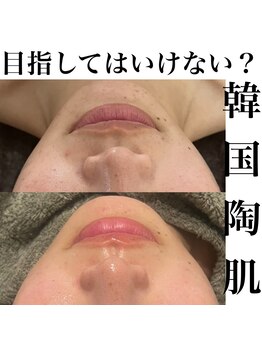 サロンツキ(salon tuki)/ハーブピーリング症例