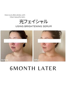 ハグミー 甲子園口(HUGME.)/若見え/小顔/トーンアップ/美肌