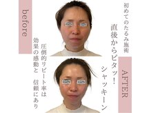 ナースセレクトサロン(Nurse select salon)/直後からピタっ！