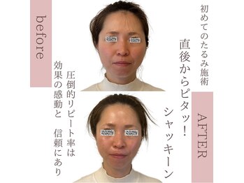 ナースセレクトサロン(Nurse select salon)/直後からピタっ！