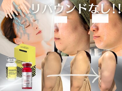 ナイア(naia)の写真