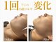 モミン(MOMI.N)の写真