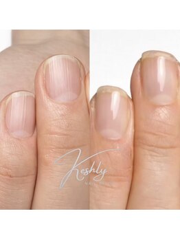 ケシュリー(Keshly)/気になる縦線もケアでツヤツヤ！