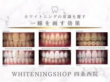 ホワイトニングショップ 四条西院店