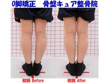 骨盤キュア整骨院/Ｏ脚矯正