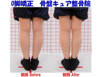 骨盤キュア整骨院/O脚矯正