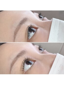 プローサム(Prorsum)/キラキラ