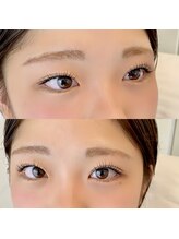 モネ(mone)/ラッシュリフト