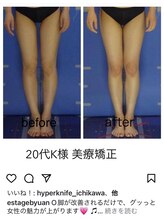 エステージ(estage)/