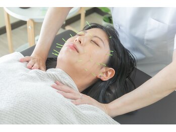 ハリシー鍼灸院/美容鍼＋首肩こりの施術です