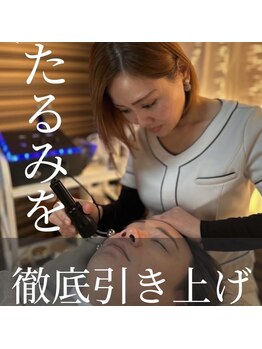 はんなり/テラボーラービフォーアフター