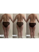 フェミニー(Feminy)/短期集中痩身