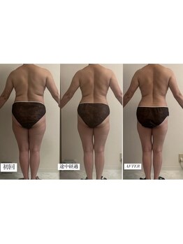 フェミニー(Feminy)/短期集中痩身