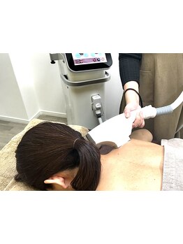 デリケート部分の脱毛/Vライン/VIO