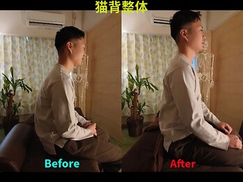 姿勢リカバリー 新宿店/猫背整体