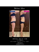 フェレザ 新潟(Felleza)/新潟-痩身エステ-BODYエステ