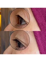 ワッカ(wacca)/【ヒト幹細胞】