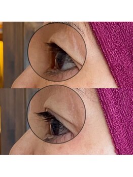 ワッカ(wacca)/【ヒト幹細胞】