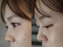 ユニ(uni)/&Healthy