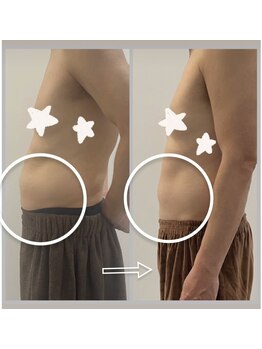 エステサロンパリス(Esthe Salon Paris)/ぽっこりお腹も◎ 