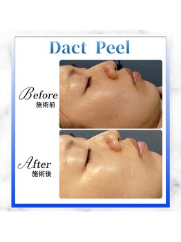 グランディールアン(GRANDIR UN)/ダクトピール