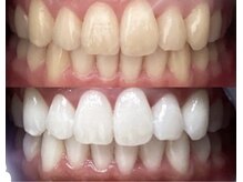 ホワイト 香里園店(WHITE)/3ヶ月後の変化《40代》