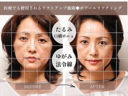 アンジュマリーの写真