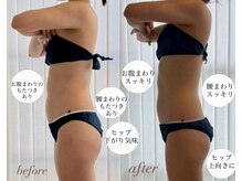 ルーチェスト(Lucest)の雰囲気（首肩/お腹/腰/背中/デコルテ施術。ラフォスオーダーメイド90分）