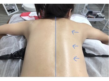 カレン/深層筋膜リリース/背中を解す