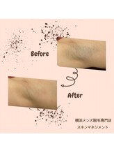 スキンマネジメント 横浜/Before &After