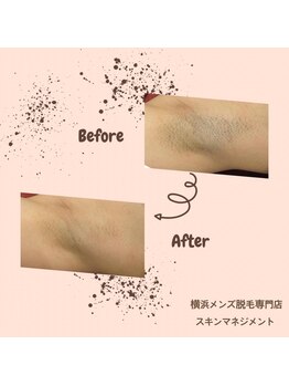 スキンマネジメント 横浜/Before &After