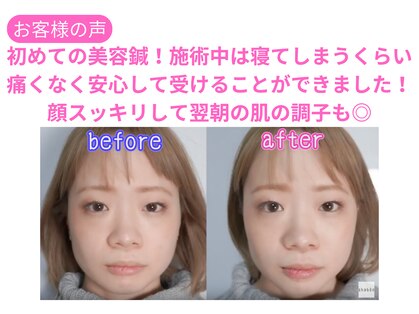 ワト(WATO)の写真