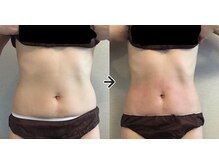 エリュクス(et Luxe)/痩身王者！ヴィーナスディーバ