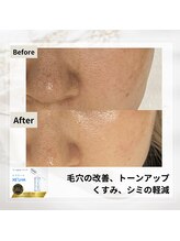 ルアナ(Luana)/セラピール効果★