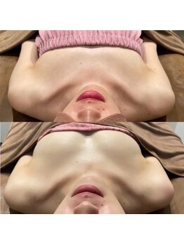 ロココ 豊田店(Rococo)/ビフォーアフター