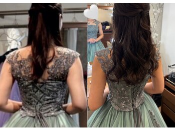 凛&美 銀座/8回施術のビフォーアフター