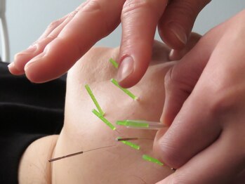 J&Mリラクシング(J&M relaxing)/美顔鍼・美容鍼