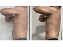 ヨルエステ(yoru aesthe)/【姿勢改善、痩身】