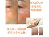 【かんぱん、色素シミ】他店でダメだった方！まぶたもOK特別シミケア￥15000