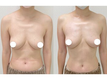 ワイサロン(Y salon)/バストを残してダイエットコース